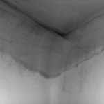 Truchlivá odevzdanost