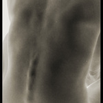 X-RAY