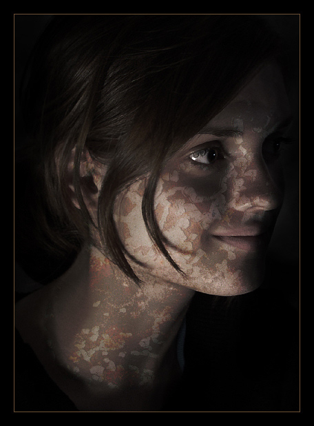 Corrosion of beauty