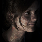 Corrosion of beauty