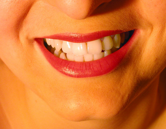 Smile!