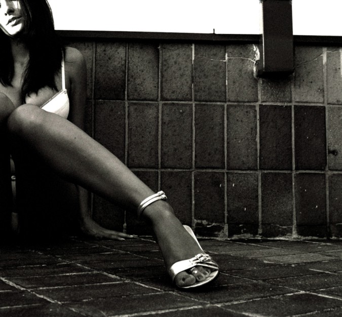 .. knock-knee ..