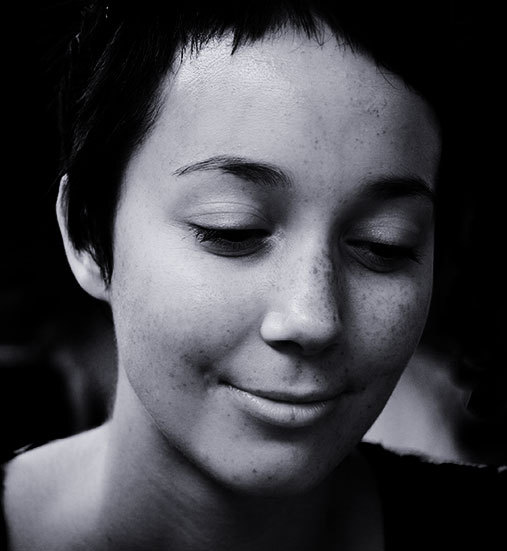 freckles