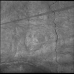 douce structure