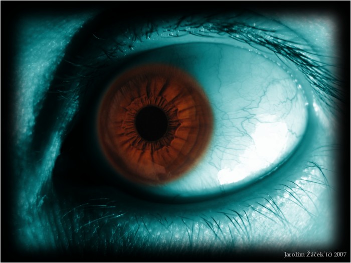 My Eye