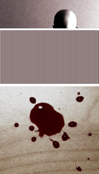 utrpení hemofylika