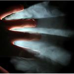 Tonoucí se světla chytá