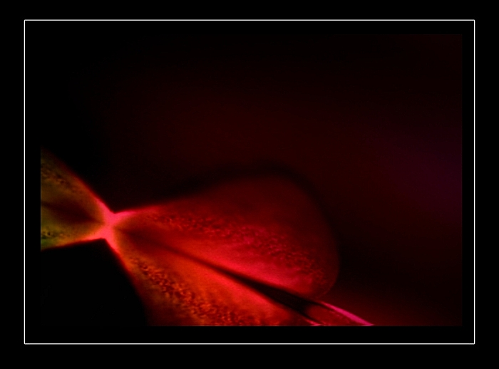 eibi - aj duša boli