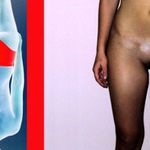 noha mé desetileté sestry