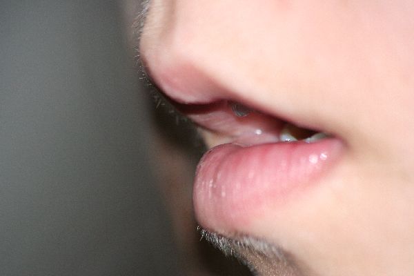 Ústa