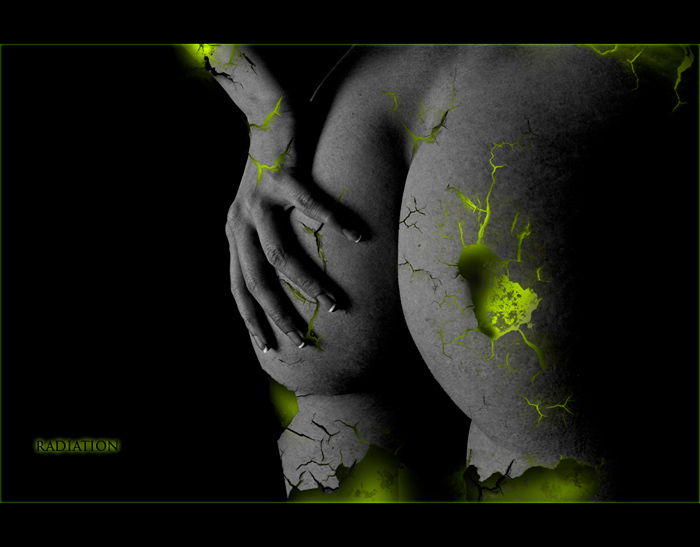 Radiation