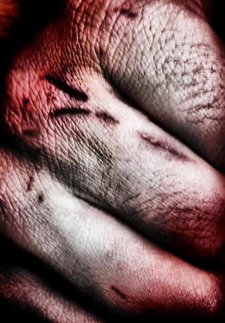 Vivere Militare Est . . .