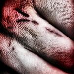 Vivere Militare Est . . .