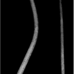 dočasné priblíženie