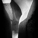 Ztracený bod nalezen - MoML 5. října 2015